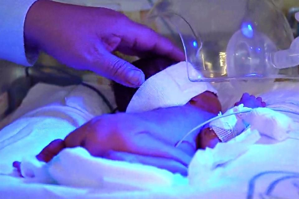 Prematuro Bebes De Cinco Meses De Gestacion Bebe De Meses De