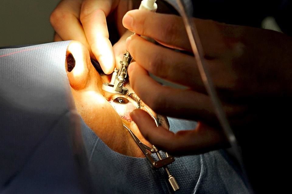 Ojos cirugia cdmx laser