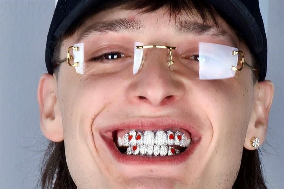 Grillz, la sonrisa del millón de dólares